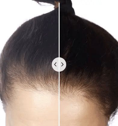 ChicBlend - 5-in-1 Multifunctional Hair Care Comb